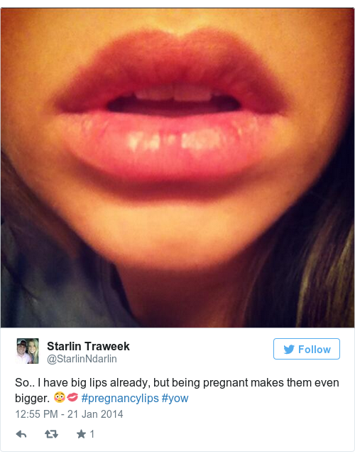 Kim Kardashian says she has 'pregnancy lips' but is that even a thing?