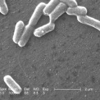 E.coli E.coli