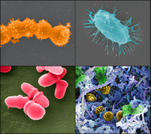 the-human-microbiome-project-which-was-launched-by-the-nih-in-2007-provided-the-first-insight-into-the-microbial-life-of-healthy-humans-and-explores-possible-relationships-between-particular-human-d
